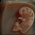 Jak rozwija się dziecko w brzuchu przyszłej mamy?