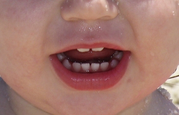 Higiena zębów dziecka