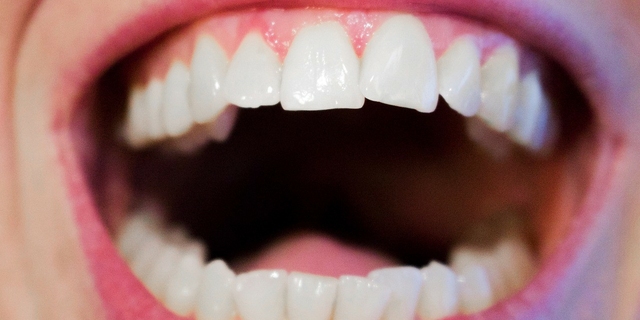 Zęby mądrości – objawy, których nie wolno lekceważyć!