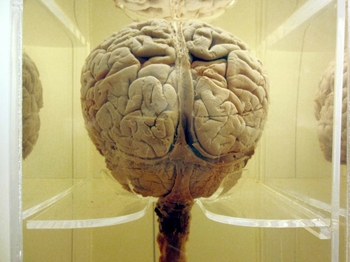Zapalenie mózgu i opon mózgowo-rdzeniowych