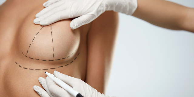Fakty i mity na temat operacji plastycznych biustu