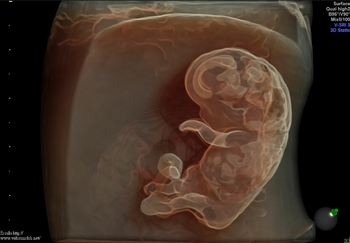 Jak rozwija się dziecko w brzuchu przyszłej mamy?