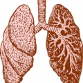 Zapalenie płuc
